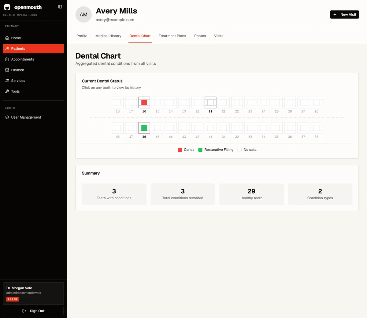 OpenMouth desktop dental chart with upper and lower tooth rows and patient context.