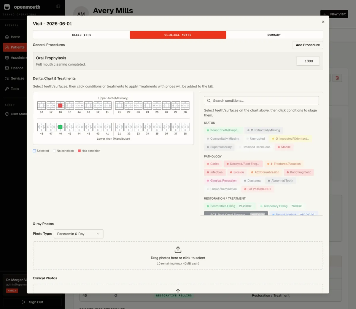 OpenMouth desktop clinical visit screen with tooth charting and procedure tools.